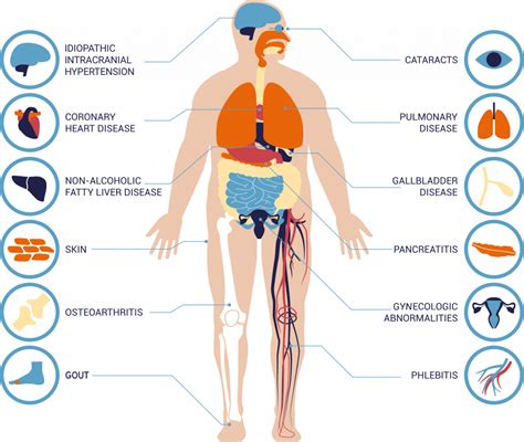 Obesity - ERX Pharmaceuticals