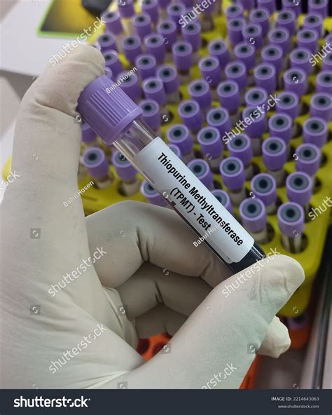 Blood Sample Thiopurine Methyltransferasetpmt Test Thiopurine Stock Photo 2214643063 | Shutterstock