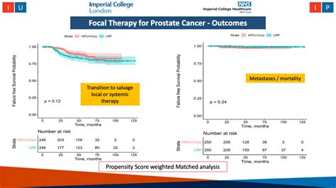 Focal Therapy for Prostate Cancer | London Prostate