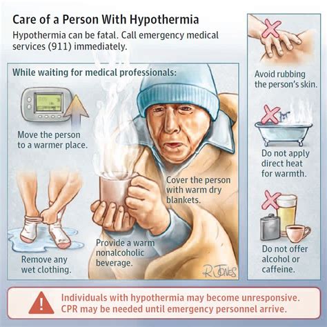 Hypothermia Symptoms Treatment And Stages