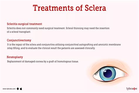 Sclera (Human Anatomy): Image, Functions, Diseases and Treatments