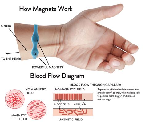 How magnetic therapy works and how it may help you | Magnet therapy, Magnets, Polarity therapy