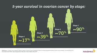 Ovarian Cancer