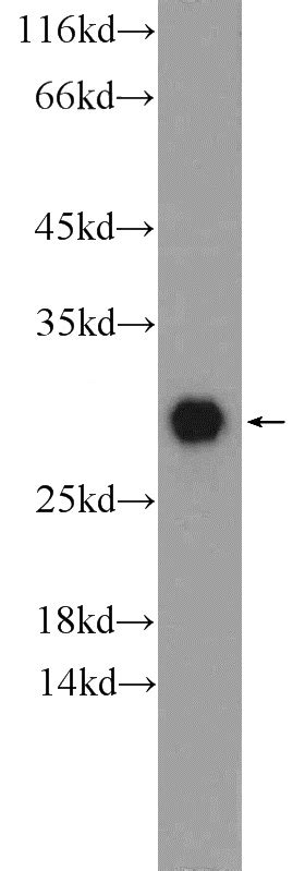 Calbindin Rabbit Polyclonal antibody