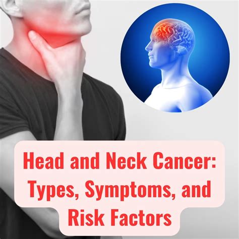 Head and Neck Cancer: Types, Symptoms, and Risk Factors