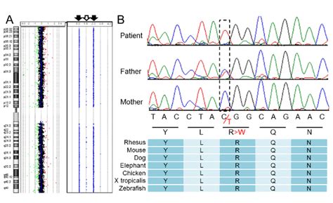 Results of genomic analyses. (A) Chromosomal microarray testing. The ...