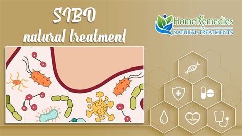 SIBO Natural Treatments - Home Natural Treatment For SIBO | Home Natural Cures - YouTube