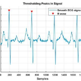 A sample of R-wave detection by applying the pick detection algorithm ...