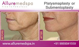 Platysmaplasty Mumbai | Platysmaplasty Surgery, Surgeon, Clinic, Cost Mumbai