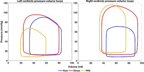 Left and right ventricle pressure-volume loops for the three simulated ...