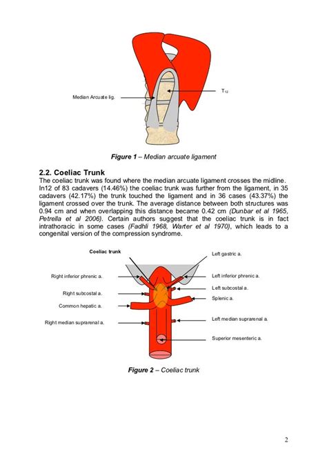 Median Arcuate Ligament Syndrome