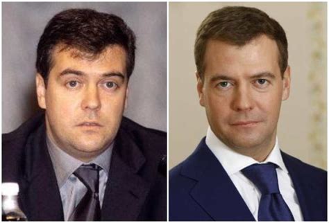 Dmitry Medvedev’s height, weight and physical changes