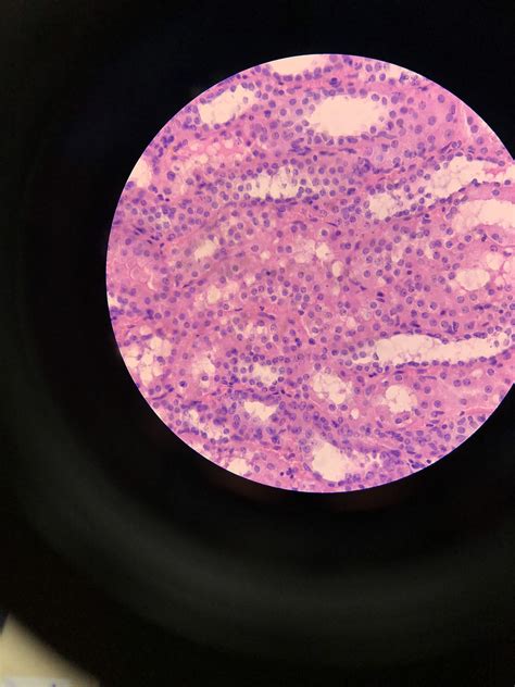 Nuclei in mitosis by staining Hematoxylin and Eosilin. Shot by me : r/Histology