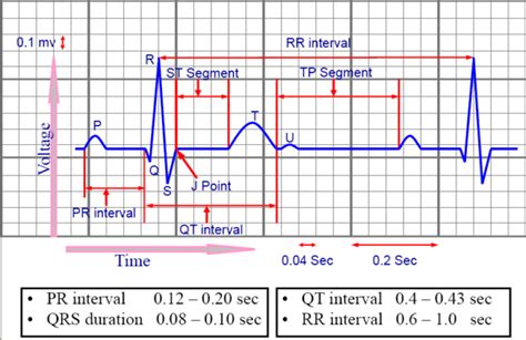 ecg – Cardiacos.net