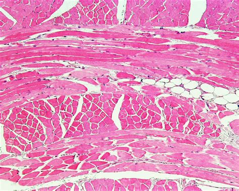 File:Skeletal muscle histology 001.jpg - Embryology