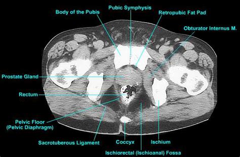 Prostate Imaging