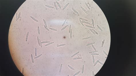 Please identify this endophytic fungi