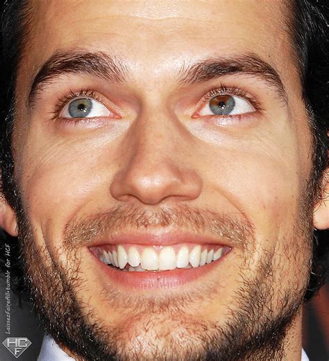 Actor Henry Cavill has sectoral heterochromia in his left eye. It is mostly blue, with a couple ...