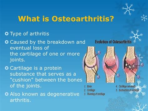 Osteoarthritis