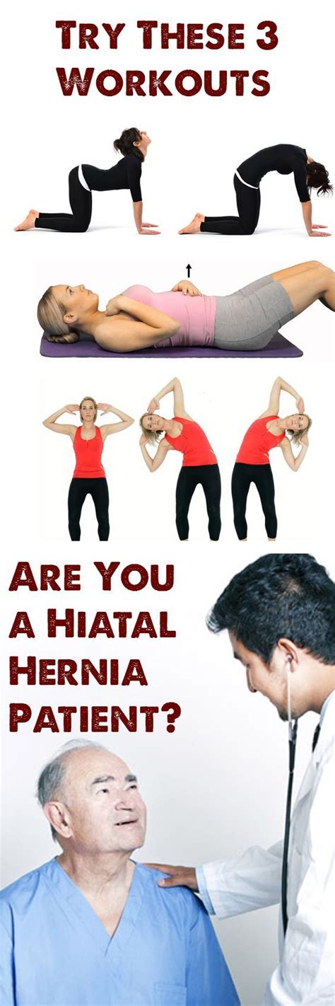 are-you-a-hiatal-hernia-patient-try-these-3-workouts #heartburnreliefinstant | Hernia exercises ...