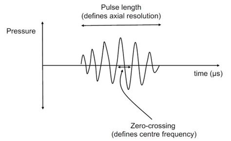 Lecture 3 - Ultrasound, B-mode imaging, ultrasound equipment Flashcards | Quizlet