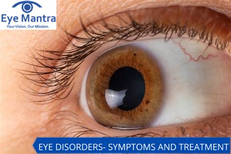 Common Eye Disorders- Symptoms And Treatment