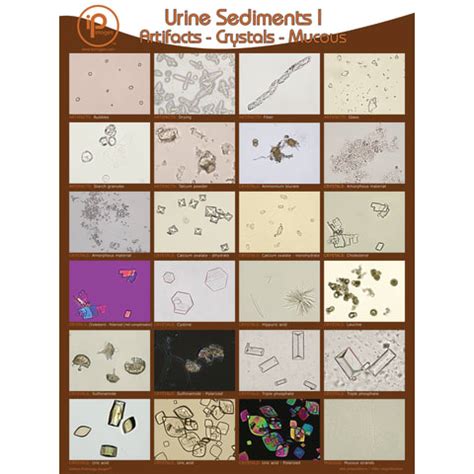 Urine Sediments, Poster I • 18"W x 24"H | Marketlab