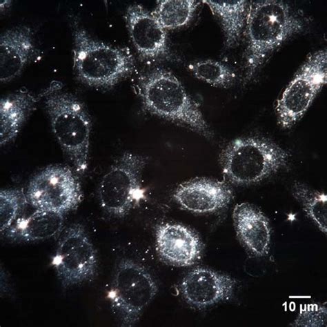 Microscope 101 - What is Darkfield Microscopy?