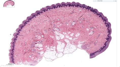 Histology - Fibrous Connective Tissue - YouTube