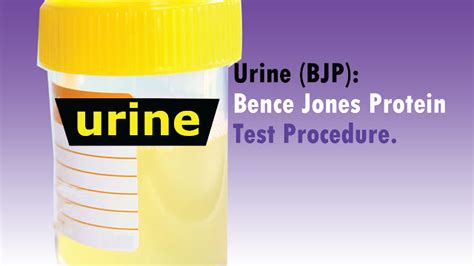 Urine Bence Jones Protein: Test Procedure: Reason to positive.