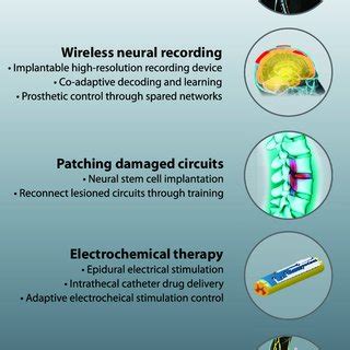 (PDF) Personalized Neuroprosthetics