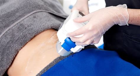 How Many CoolSculpting Treatments Are Necessary? | Health and Aesthetics