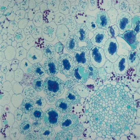 Fungi Demonstration Microscope Slides | Carolina.com