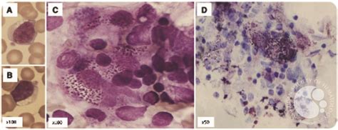 Morphology in mucopolysaccharidosis type III: specific diagnostic features