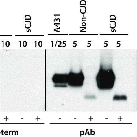 Antibody mapping of caveolin-1 from cultured cells or human brains.... | Download Scientific Diagram