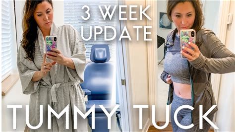 Postpartum tummy tuck before and after - diyGros