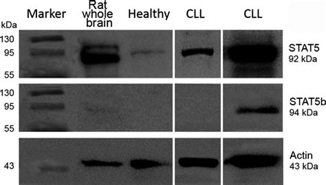 Protein immunoblot results. The figure includes the immunoblot results ...