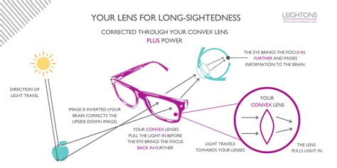 Understanding your eyesight prescription | Leightons