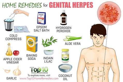 Home Remedies for Genital Herpes | Top 10 Home Remedies