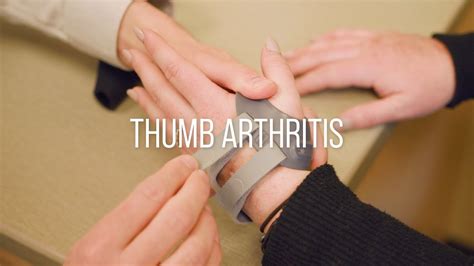 Basal Thumb Arthritis Treatment