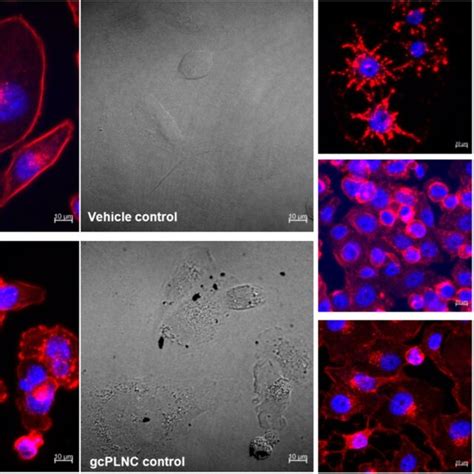 Confocal microscopic images showing preferential cytosis mechanism of ...