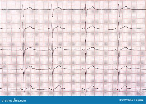 Heart Rhythm Chart Royalty-Free Stock Photography | CartoonDealer.com #29491601