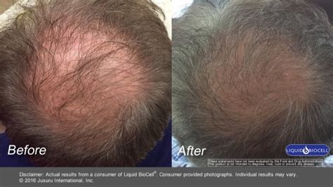 HAIR GROWTH - MEN - Liquid BioCell Collagen