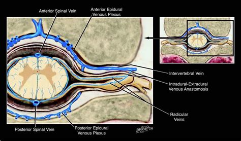 NORMAL AREAS OF SPINAL ENHANCEMENT ON MRI - Radedasia