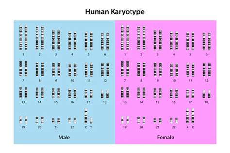 Caryotype images libres de droit, photos de Caryotype | Depositphotos