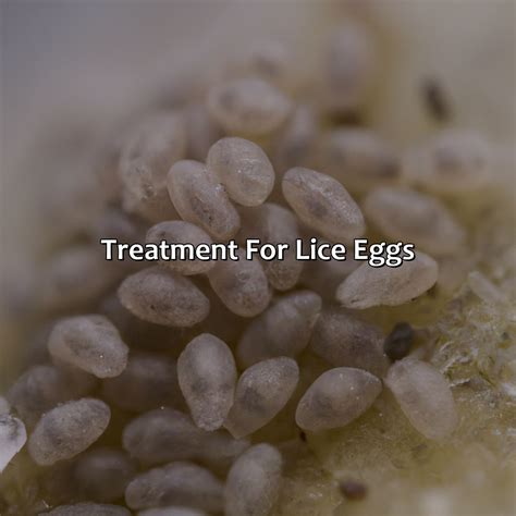 What Color Are Lice Eggs - colorscombo.com