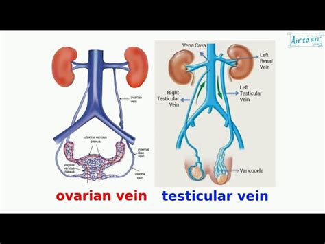 Gonadal Vein Anatomy