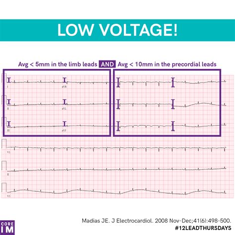 What Voltage Does The Us Use