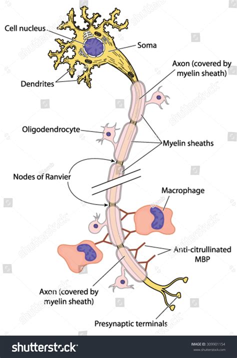 Myelinated Nerve Multiple Sclerosis Showing Action Stock Vector ...