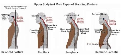 weak upper back muscles - PositiveMed